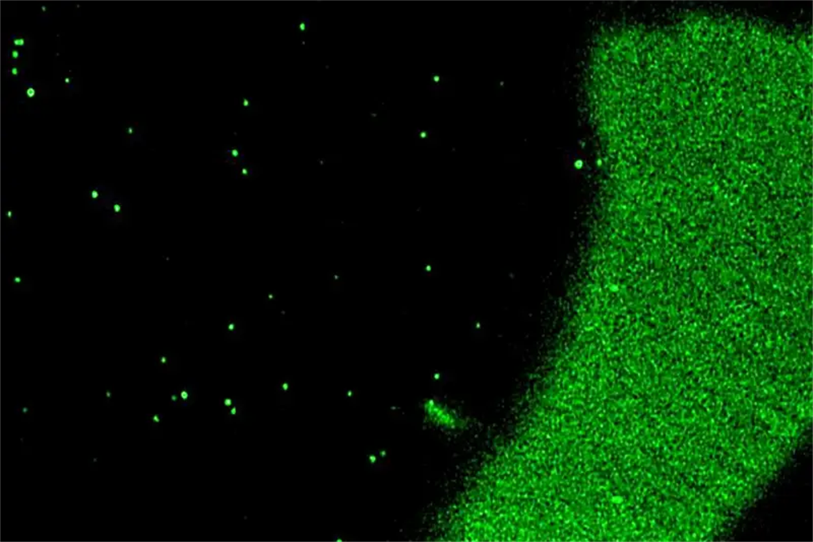 Using a Zeiss LSM 880 confocal microscope with Airyscan detector, researchers in UD Assistant Professor Jessica Tanis' lab can image extracellular vesicles, which are made visible by a green fluorescent protein. "To someone who has never looked at EVs before, they look like stars in the sky," Tanis says. On the right is a portion of the worm model she uses.